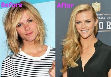 brooklyn decker leak|Brooklyn Decker Plastic Surgery Before and After Photos